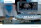 Leistung trifft auf Ergonomie – ACUSON X300 Premium Edition · PDF filein dieser Aufnahme des fetalen Circulus Willisii zu erkennen. Hochfrequenz-Bildgebung und Farbdoppler • Darstellung